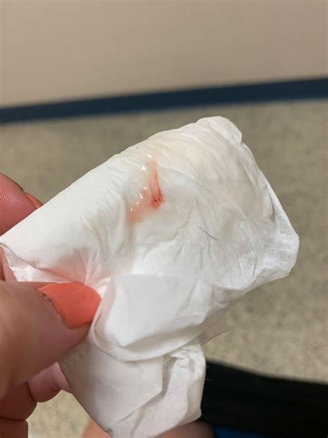 Aug 19, 2019 These discharges may appear Clear watery. . Discharge that looks like tissue